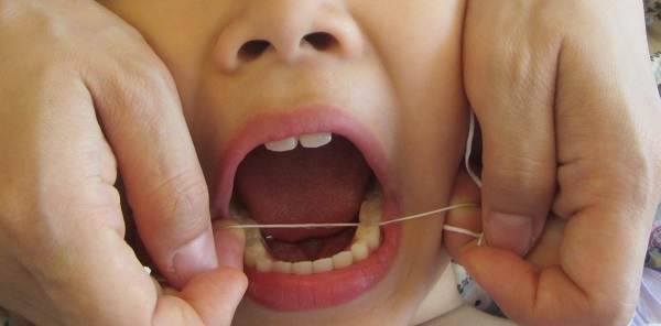 치실을 사용해 치아 사이를 닦아준다.