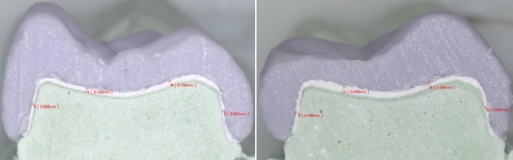 시멘트 갭차이를 비교한 실험에서 오스템 OneMill 4x(왼쪽)는 경쟁제품과 비교해 정밀한 결과를 보였다.