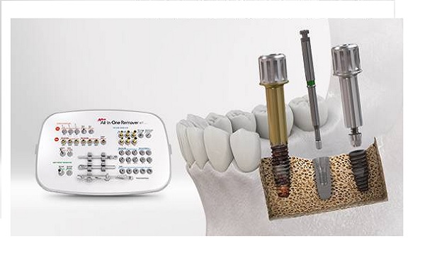 네오바이오텍의 임플란트 토탈 리페어 솔루션 ‘All-in-One Remover Kit’.